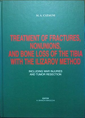 Treatment of fractures, nounions and bone loss of the tibia with the Ilizarov method