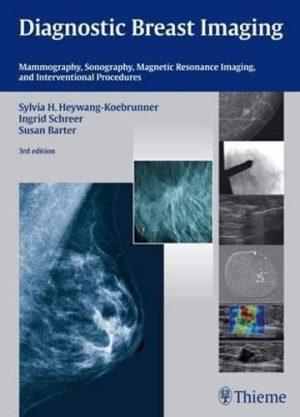 Diagnostic Breast Imaging: Mammography, Sonography, Magnetic Resonance Imaging and Interventional Procedures [Lingua inglese]