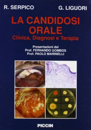 La Candidosi Orale.Testo Atlante. [Copertina flessibile] by Serpico - Liguori