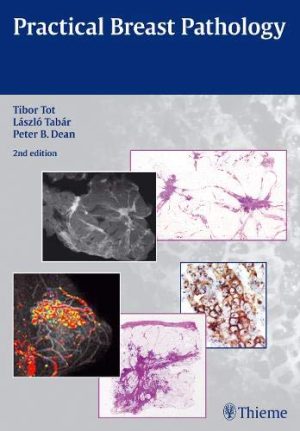 Practical breast pathology