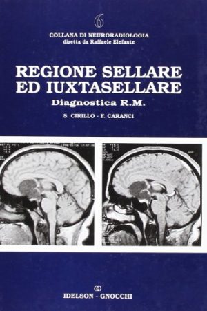 Regione sellare ed iuxtasellare
