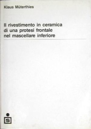 Il rivestimento in ceramica di una protesi frontale nel mascellare inferiore