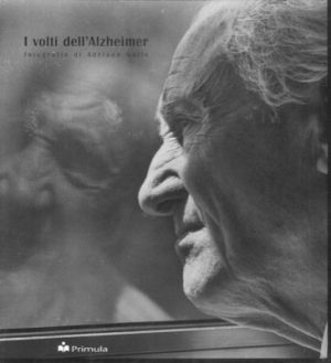I volti dell'Alzheimer.