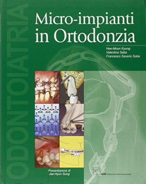 Micro-impianti in ortodonzia. Con CD-ROM