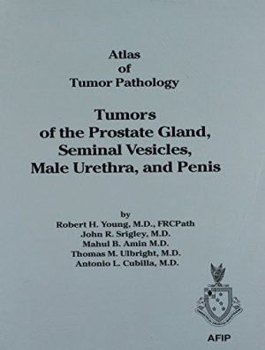 Tumors of the Prostate, Seminal Vesicles, Male Urethra and Penis: 28