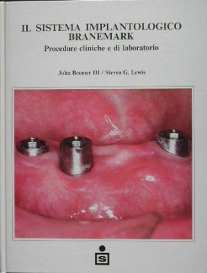Il sistema implantologico Branemark